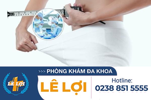 Keo-dai-duong-vat-o-dau-an-toan